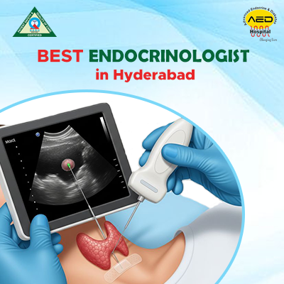 Best Endocrinologist in Hyderabad 