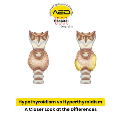 Hypothyroidism vs Hyperthyroidism